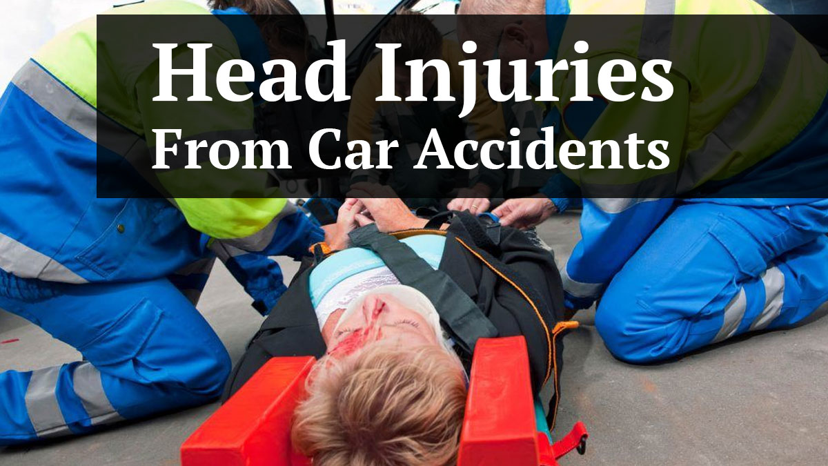Head Injuries After a Car Accident in St. Petersburg