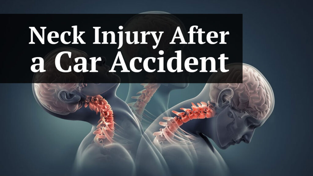 neck injury after a car accident