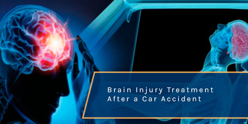 Finding the Right Brain Injury Treatment After a Car Accident in Florida