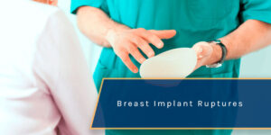 Breast Implant Ruptures After An Auto Accident in 2025